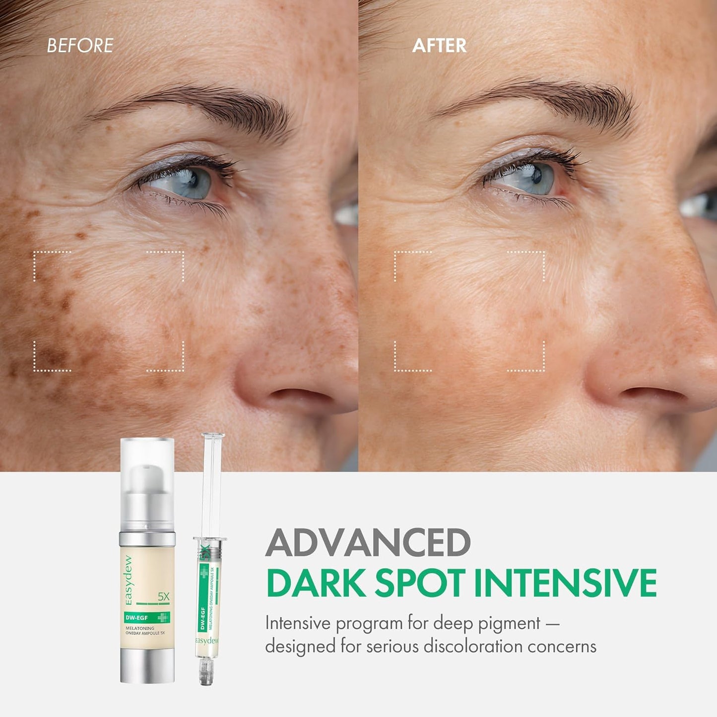 Easydew DW-EGF Melatoning Ampoule 5X Dark Spot Serum | B0FPFM8V3C | U.S. ONLY