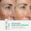 Easydew DW-EGF Melatoning Ampoule 5X Dark Spot Serum | B0FPFM8V3C | U.S. ONLY