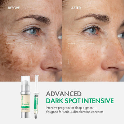 Easydew DW-EGF Melatoning Ampoule 5X Dark Spot Serum | B0FPFM8V3C | U.S. ONLY
